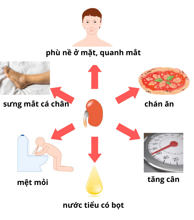 trieu-chung-hoi-chung-than-hu.png