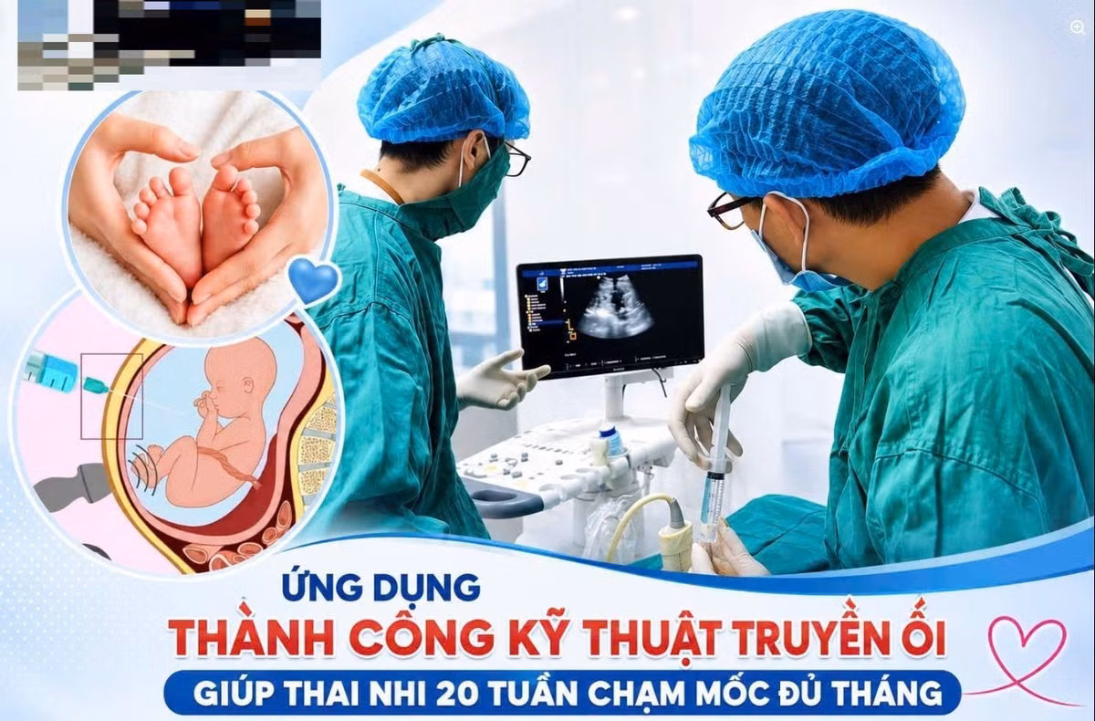 than-can-oi-1102.jpg