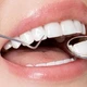 Biến chứng khi làm răng sứ giá rẻ