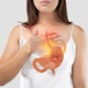 Trào ngược dạ dày có thể biến chứng thành ung thư thực quản