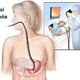 Khi nào nên nội soi tiêu hóa?