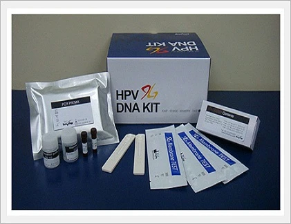 Kiểm tra HPV có thể phát hiện ung thư cổ tử cung