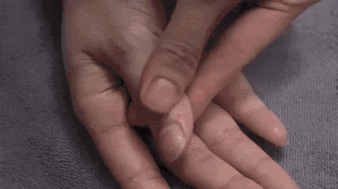 Bấm huyệt tay, chân trị viêm amiđan cấp, mạn tính