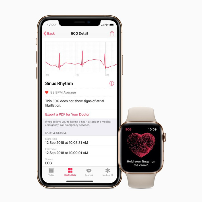 Apple Watch là một trong những thiết bị đeo thông minh nổi bật nhất hiện nay, kết hợp giữa công nghệ tiên tiến và thiết kế hiện đại. Đồng hồ này có thể đo điện tâm đồ (ECG), đo nồng độ oxy trong máu và hỗ trợ phát hiện ngưng thở khi ngủ, giúp người dùng theo dõi sức khỏe tim mạch và hô hấp hiệu quả.(Ảnh: Apple)