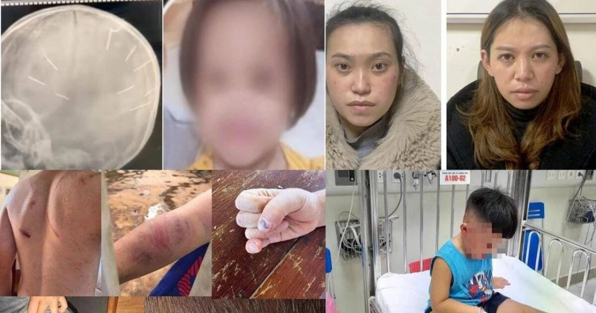Sát hại con, đánh cháu... buồn lòng những vụ bạo hành trẻ em năm 2022