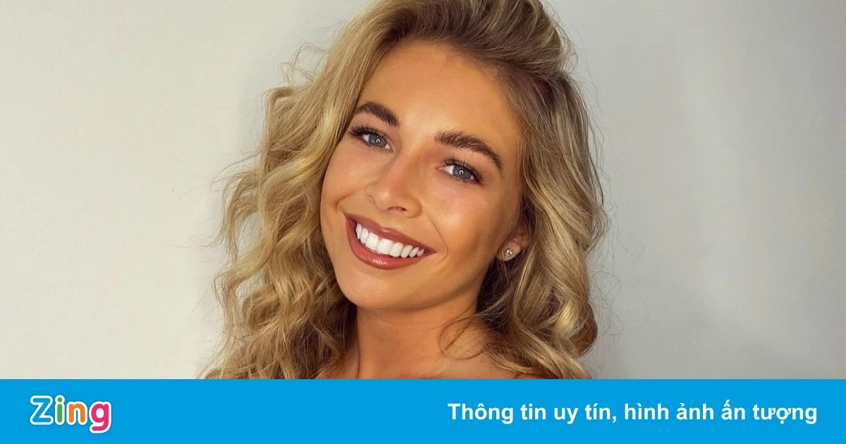 Nàng WAGs quyến rũ giúp Scott McTominay tìm lại phong độ