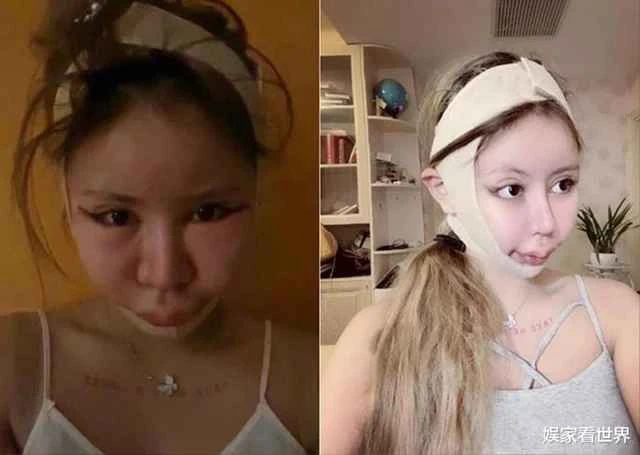 Chi 14 tỷ cho 200 ca PTTM, cô gái hối hận nhìn lại quá khứ