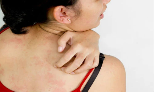 10 dấu hiệu ung thư dễ dàng bị bỏ qua