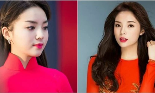 Hành trình “biến đổi” cằm vuông thành cằm nhọn của Kỳ Duyên 