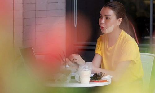 Lộ ảnh Trà Ngọc Hằng mặt sưng húp, dán băng keo chằng chịt