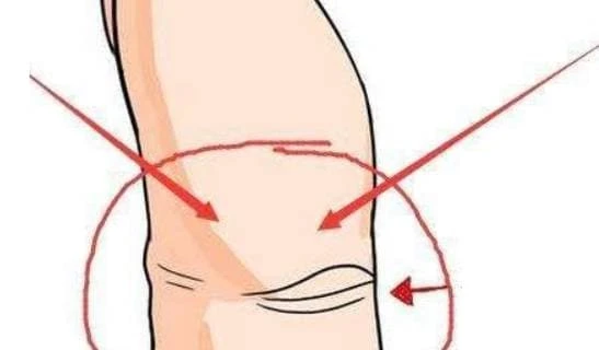 Phụ nữ có 'Mắt thần' ở ngón tay cái bên phải nhất định giàu có