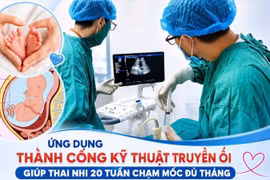 Thai cạn ối từ tuần 20 vẫn giữ được con nhờ kỹ thuật truyền ối