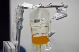 Thời điểm vàng điều trị bệnh tự miễn, tổn thương thận bằng lọc huyết tương