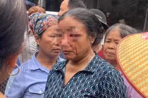Xác minh thông tin người bán rau bị xịt nước chảy máu mặt ở Phú Thọ