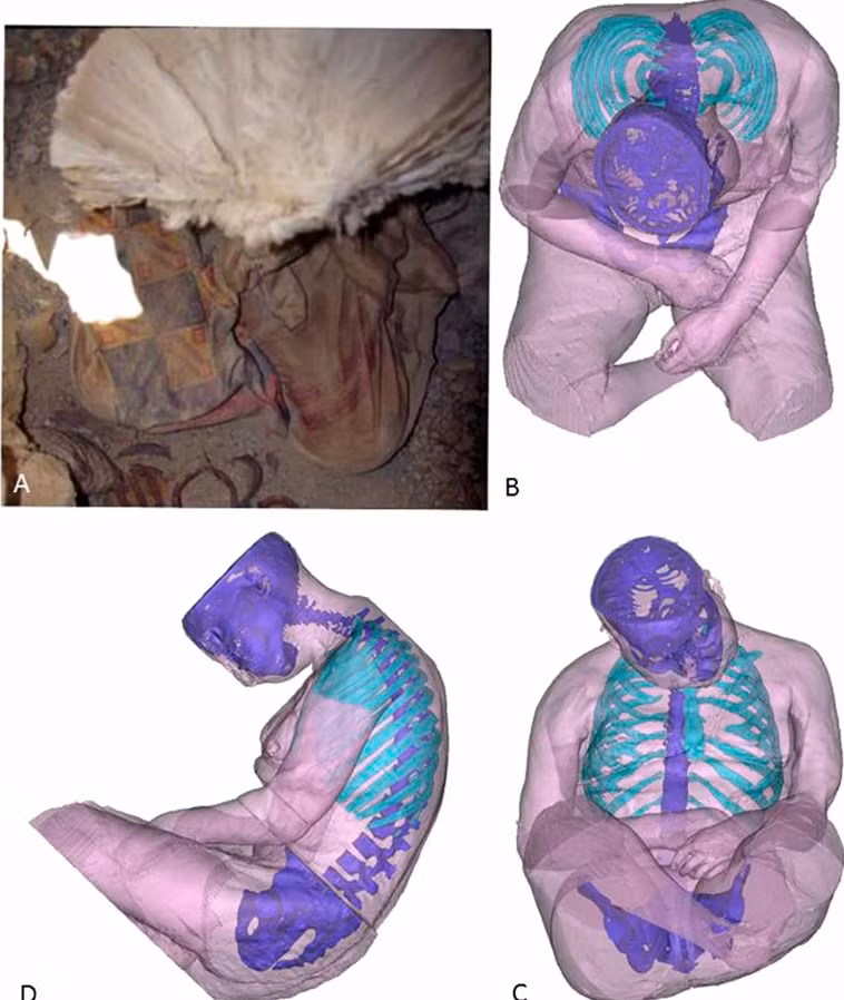 Lần đầu tiên, các nhà khoa học đã sử dụng phương pháp chụp cắt lớp vi tính (CT) để kiểm tra không xâm lấn các nạn nhân xác ướp. Ảnh: @Đại học Warsaw.