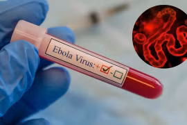 Bộ Y tế hỏa tốc yêu cầu phòng chống Ebola