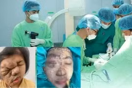 Cô gái trẻ thoát khỏi khối u khổng lồ sau 17 năm sống chung