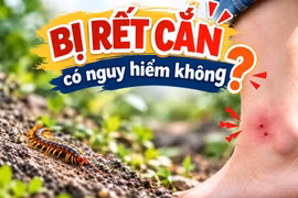 Cảnh báo rết cắn tăng cao tại Quảng Ninh, bác sĩ bày cách sơ cứu hiệu quả