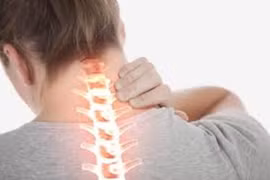 Người bệnh thoát vị đĩa đệm cần kiêng thực phẩm gì?