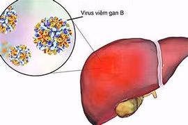 Các con đường lây nhiễm viêm gan B phổ biến, cách phòng ngừa