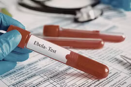 TP HCM siết giám sát cửa khẩu để ngăn nguy cơ dịch xâm nhập dịch Ebola