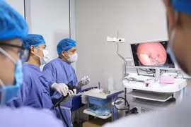 Bé trai 13 tuổi thoát khỏi nguy cơ lồng ruột nhờ phẫu thuật polyp đại tràng