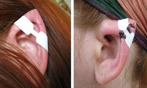 Ghê rợn những màn biến đổi cơ thể của con người 
