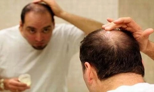 Những thực phẩm tốt cho mái tóc nên bổ sung ngay