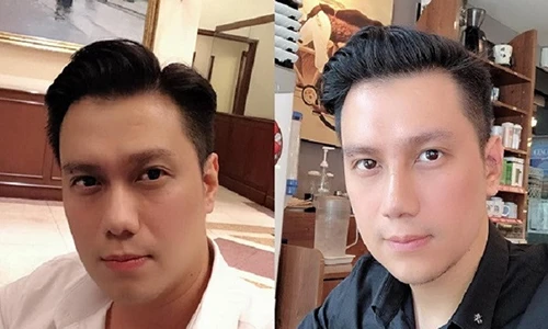 Việt Anh lên tiếng giữa ồn ào bị chê dao kéo xấu