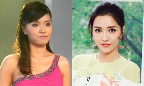Bất ngờ dung nhan trước khi dao kéo mũi, cằm của Bích Phương
