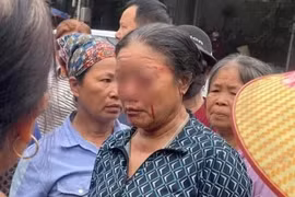 Cần xử lý nghiêm vụ xịt nước người bán rau ở Phú Thọ gây tổn thương mắt?