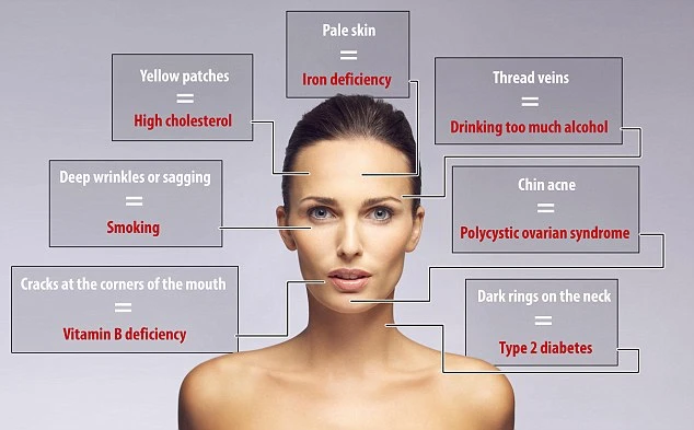 7 dấu hiệu bệnh nan y dễ nhận thấy trên mặt bạn