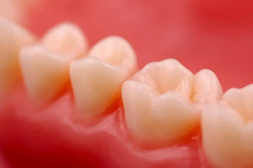 Mẹo chữa viêm lợi tại nhà, giảm chảy máu chân răng