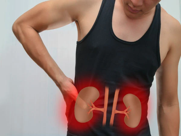 6 chiêu làm tan sỏi thận rất nhanh, không cần mổ