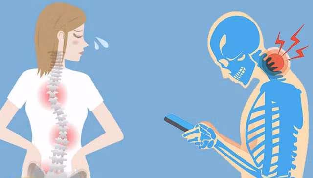 Các chuyên gia gọi tình trạng này là “hội chứng cổ công nghệ”, một vấn đề sức khỏe đang ngày càng phổ biến ở người trẻ tuổi. Những cơn đau cổ, đau vai gáy kéo dài không chỉ gây khó chịu trong sinh hoạt hằng ngày mà còn có thể ảnh hưởng đến chất lượng giấc ngủ và hiệu suất làm việc nếu không được điều chỉnh kịp thời.