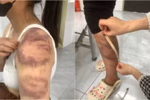Công an Bắc Ninh tạm giữ người đàn ông đánh đập vợ con