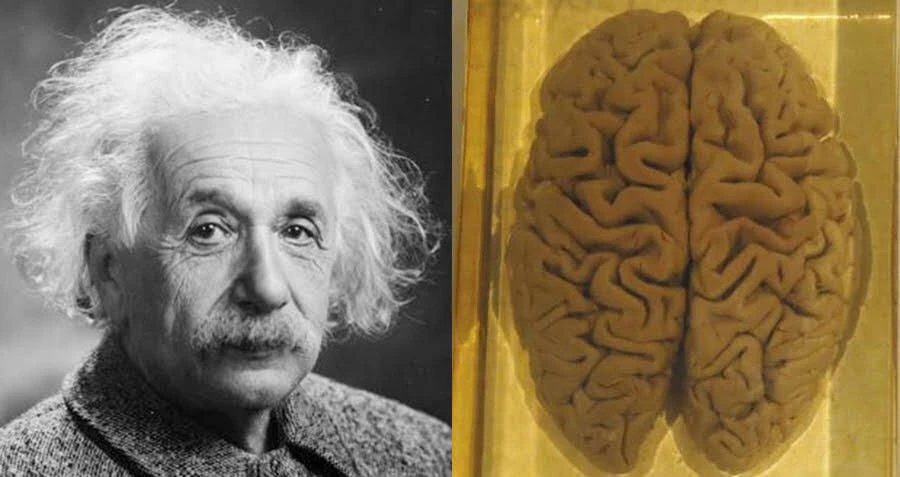 Bộ não của thiên tài Einstein được "mổ xẻ" thế nào? 