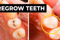 Phát minh loại gel có thể tái tạo men răng 