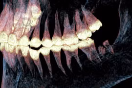 Chụp CT, phát hiện bất ngờ về thi hài phụ nữ Scythia 2.500 tuổi