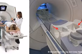 Phát triển phương pháp mới ứng dụng AI trong chẩn đoán ung thư