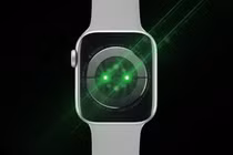 [GALLERY] Vì sao smartwatch luôn nhấp nháy đèn xanh dưới cổ tay?