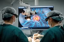 AI lần đầu đi mổ não, bác sĩ vẫn trực tiếp cầm dao