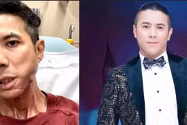 Bạn Kasim Hoàng Vũ tiết lộ tình trạng hiện tại của anh khiến fan xót xa