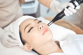 Công nghệ laser trong điều trị sẹo rỗ, nám da