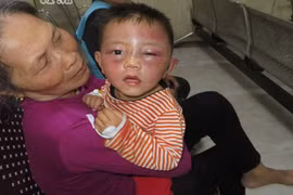 Bắt khẩn cấp gã cha dượng đánh gục con riêng của vợ