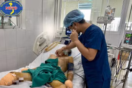 Ăn miếng dồi lợn người đàn ông bị cắt bỏ 2 chân và các ngón tay
