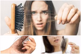 Bí quyết ăn uống ngừa rụng tóc