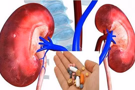 Loại thuốc chống đông có thể tổn thương thận nghiêm trọng