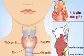 Tuyến giáp