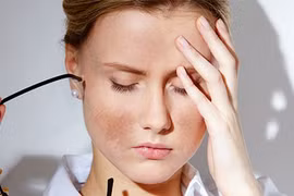 6 tuyệt chiêu chống nám da ngày hè